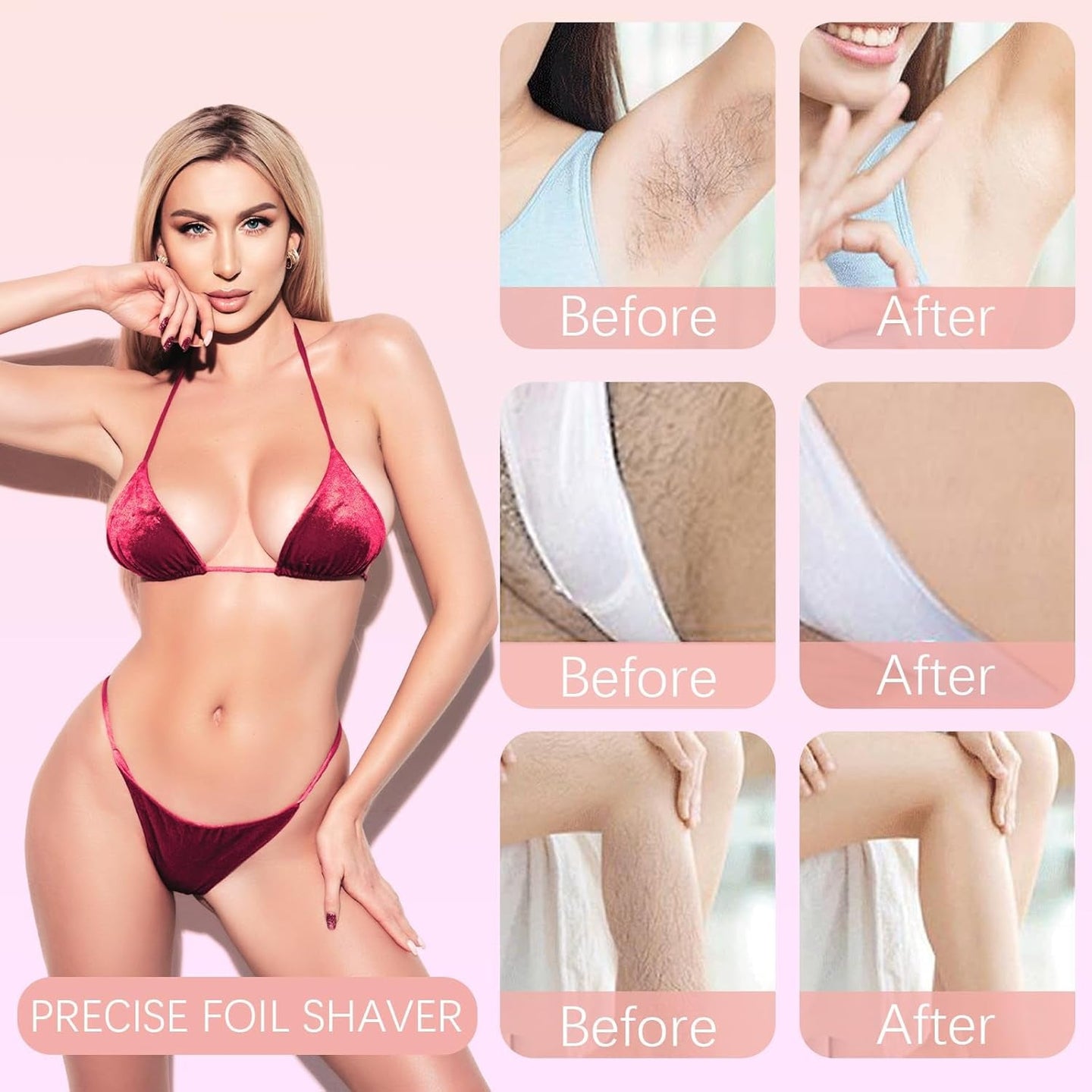 Dermavee 1