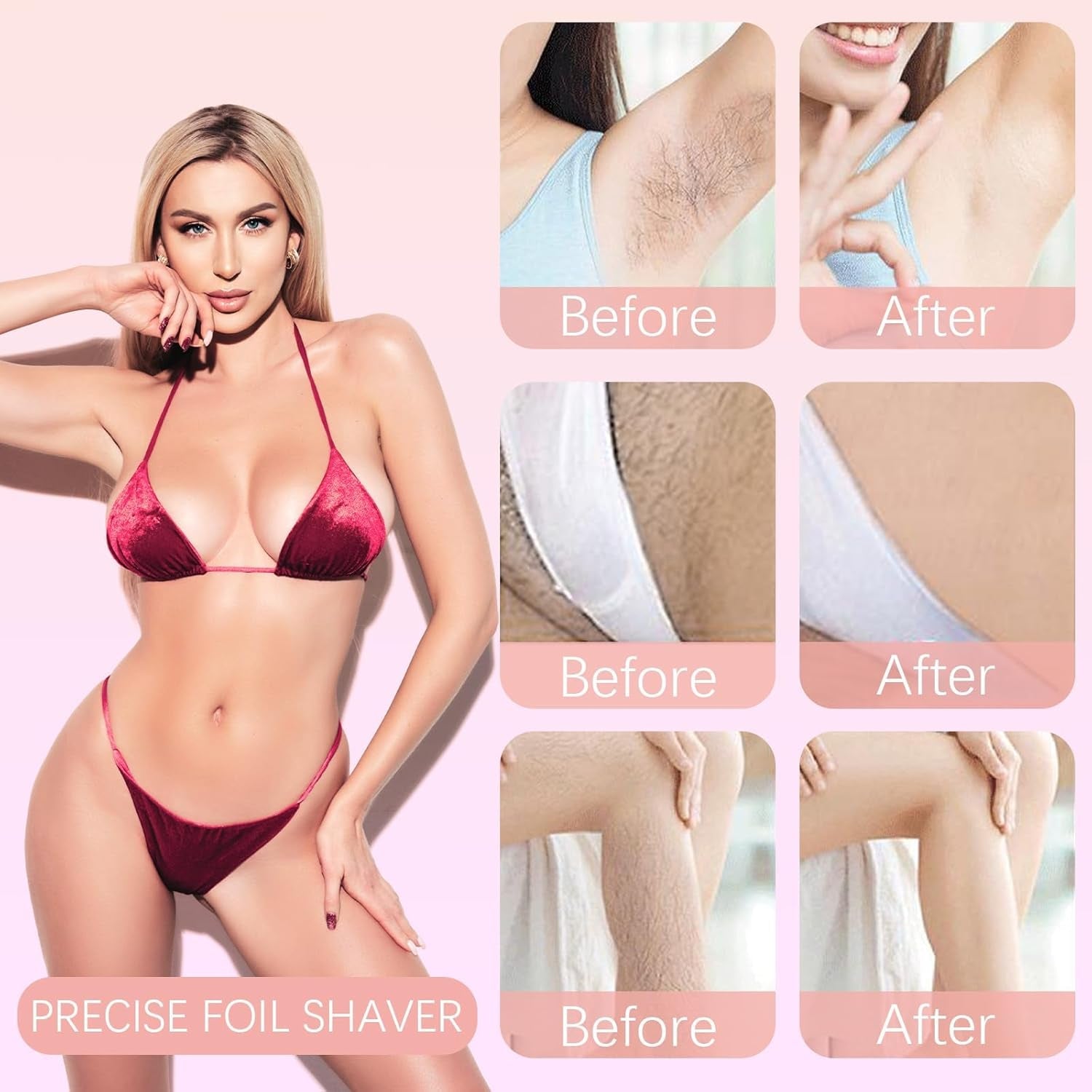 Dermavee